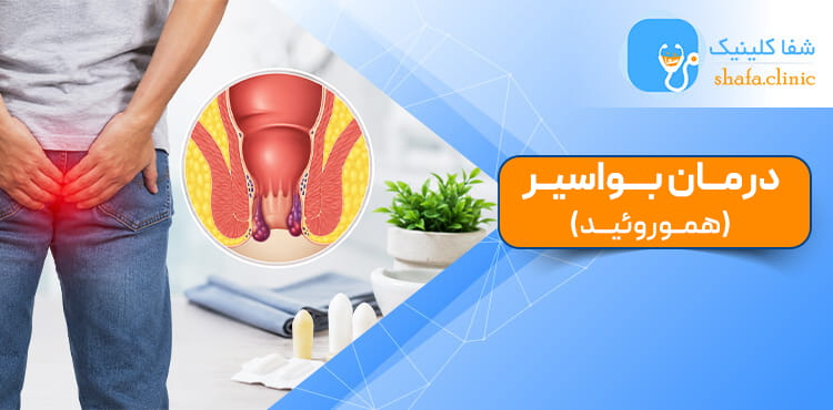 بنر راهنمای درمان بواسیر (هموروئید) و روشهای موثر برای کاهش علائم