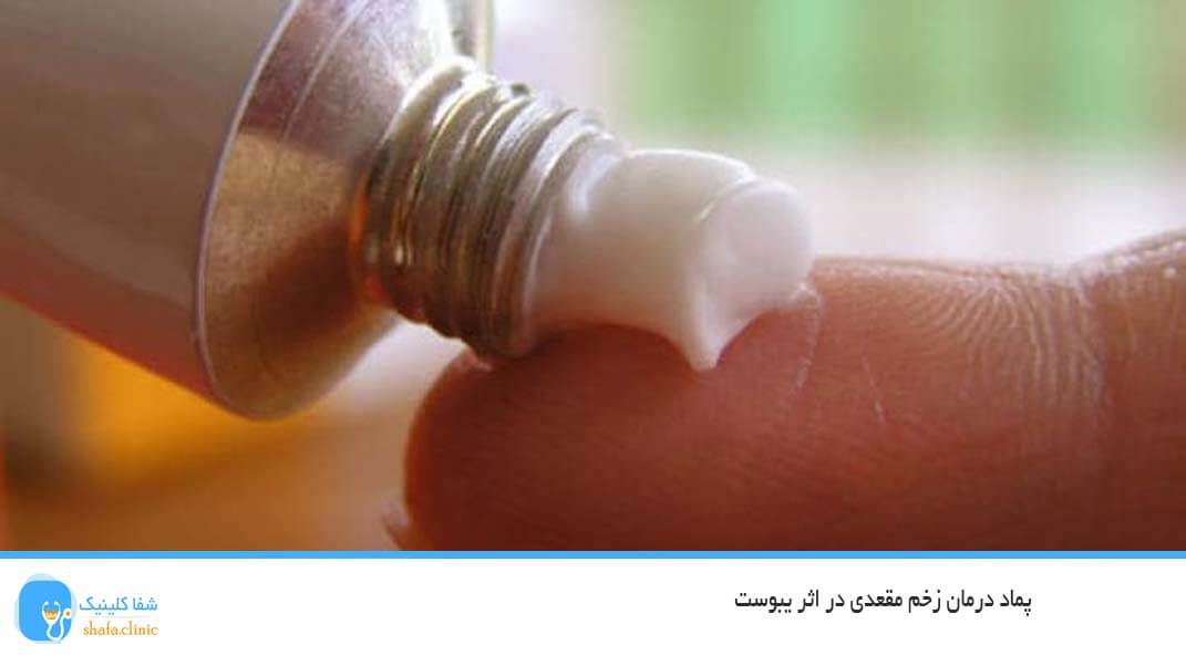 پماد درمان زخم مقعدی در اثر یبوست