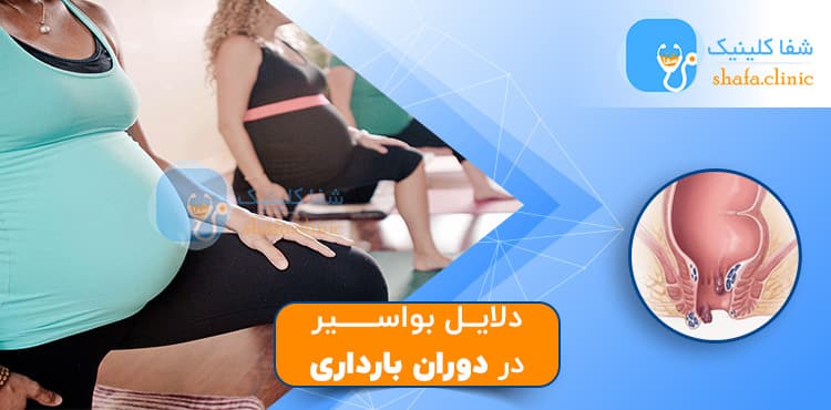 دلایل-بواسیر-در-بارداری