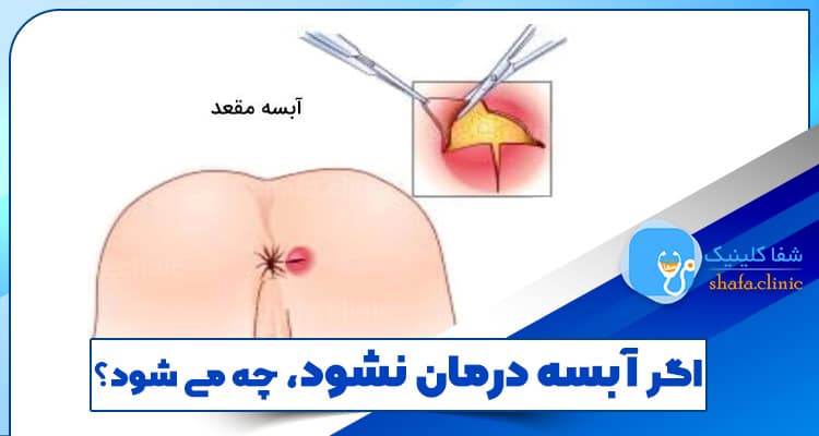 What happens if the abscess is not treated