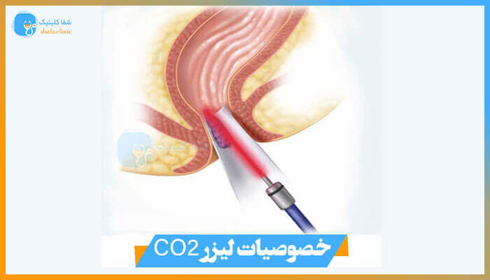 خصوصیات لیزر CO2