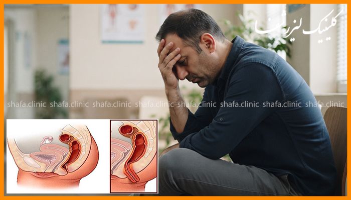 چه بیماری هایی می توانند باعث علائم مقعدی شوند؟