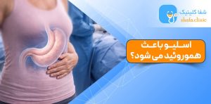آیا اسلیو باعث هموروئید می شود؟