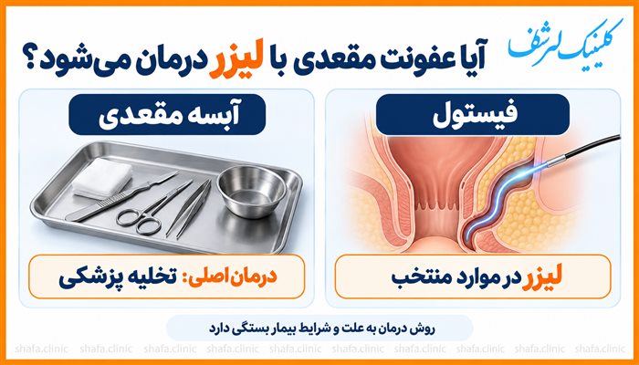 اینفوگرافیک درمان عفونت مقعدی با لیزر: آبسه با تخلیه پزشکی و لیزر فیستول در موارد منتخب