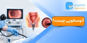 آنوسکوپی چیست؟ تصویری از معاینه کانال مقعد با آنوسکوپ